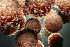 Korszakalkotó tanulmány változtathatja meg a rákbetegségek kezelését