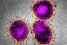 Koronavírus: csökkent a napi halálesetek száma