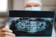 Házkutatásokat tartottak a fogászaton meghalt 4 éves gyerek ügyében