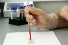 Személyre szabottabb rákkezelést tesz lehetővé egy új vérvizsgálat