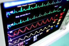 A vérkeringés összeomlására figyelmeztető algoritmust fejlesztettek ki