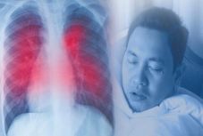 Ezek lehetnek a koronavírus-fertőzés tünetei