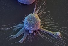 Szuperidős sejteket programoztak át őssejtekké