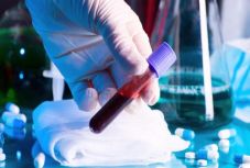 Újabb három személy hunyt el koronavírus-fertőzés miatt Romániában