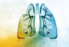 Az őssejtek segíthetnek a Covid-19-tüdőgyulladás kezelésében