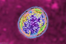 Több ezer ember fertőződött meg Kínában brucellózissal 