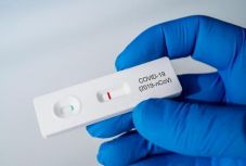 Koronavírus: tömeges tesztelésbe kezdett Szlovénia