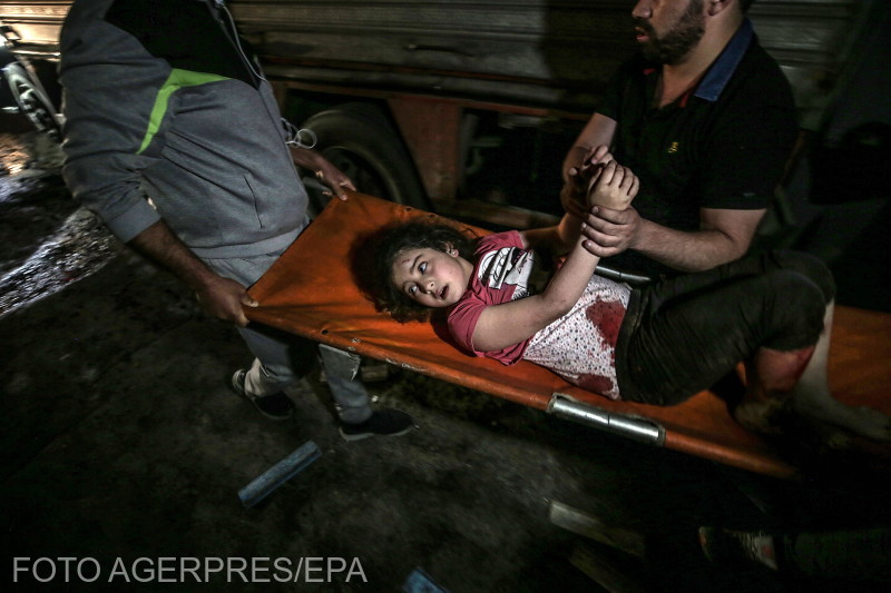 A rakétatámadás egyik sebesültje Gázában | Fotó: Agerpres/EPA