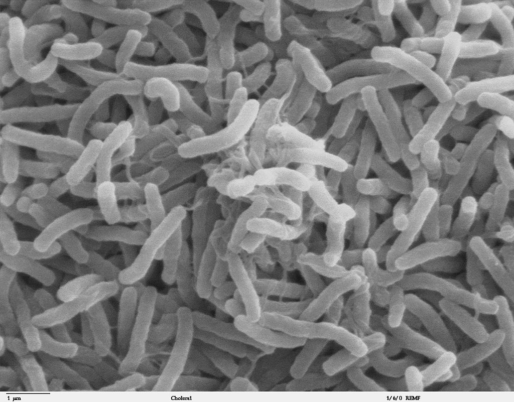 A Vibrio cholerae nevű baktérium | Fotó forrása: Wikipedia