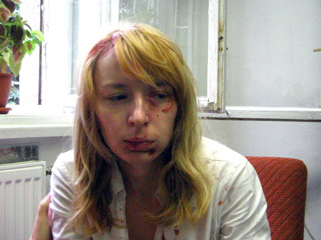 Malina Hedvig a támadás után l Fotó: blikk.hu