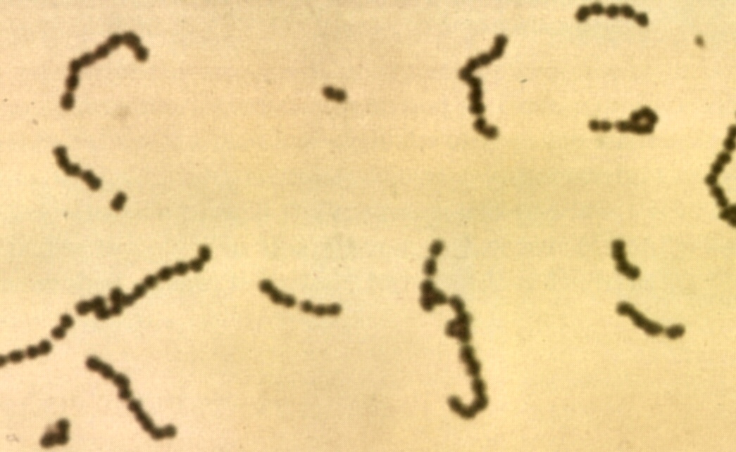 Gram-festett streptococcusok fénymikroszkópos képe | Fotó forrása: Wikipédia