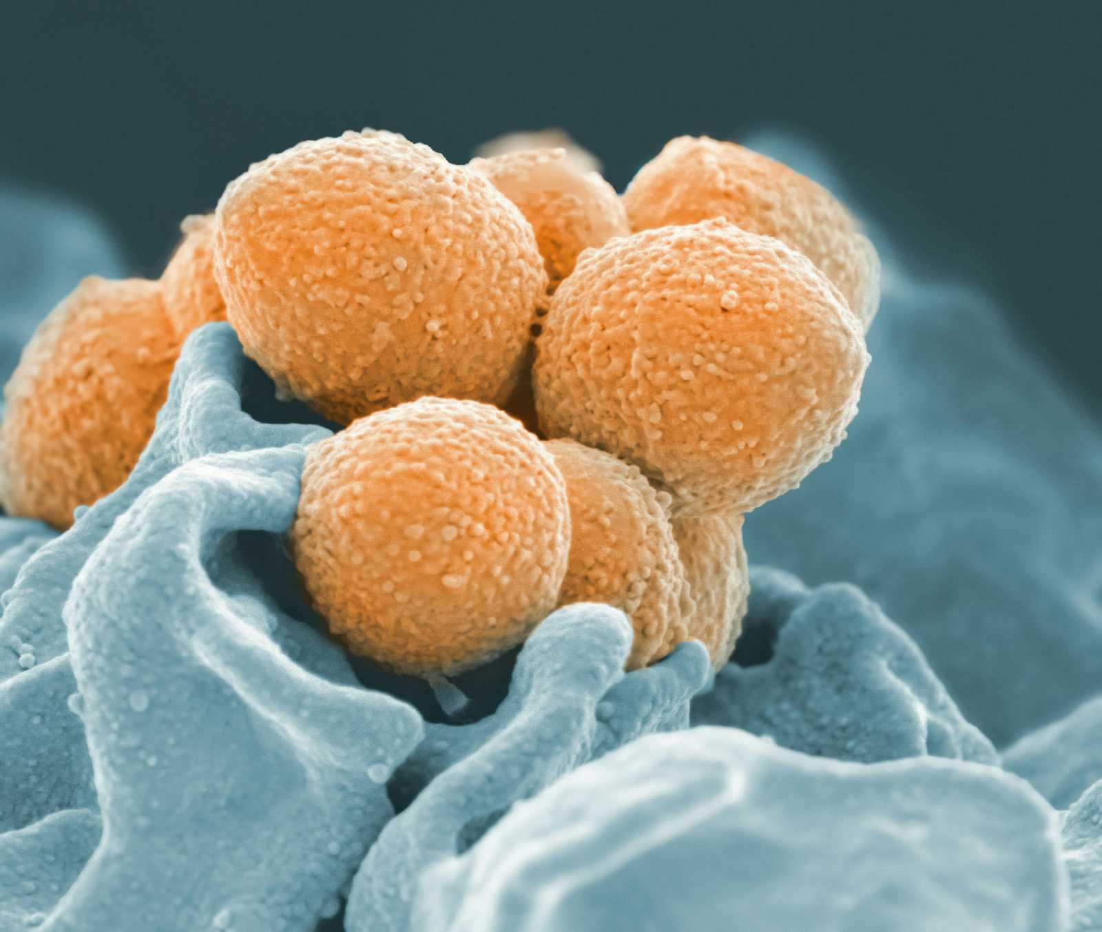 Streptococcus Pyogenes | Fotó forrása: Pixabay