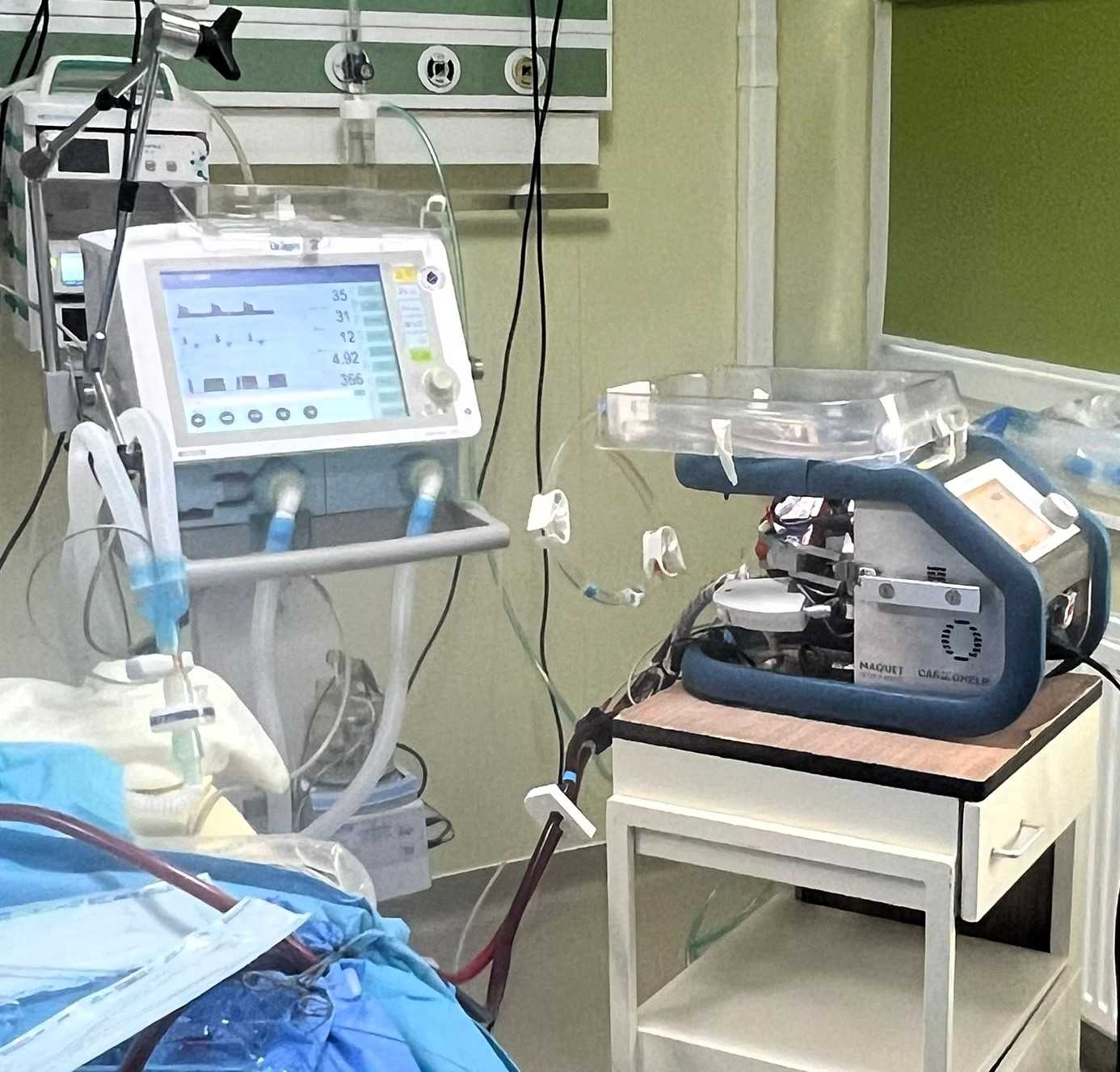 A szakértők mobil ECMO-készüléket hoztak magukkal Nagyváradról | Fotó: Csíkszeredai Megyei Sürgősségi Kórház/Facebook