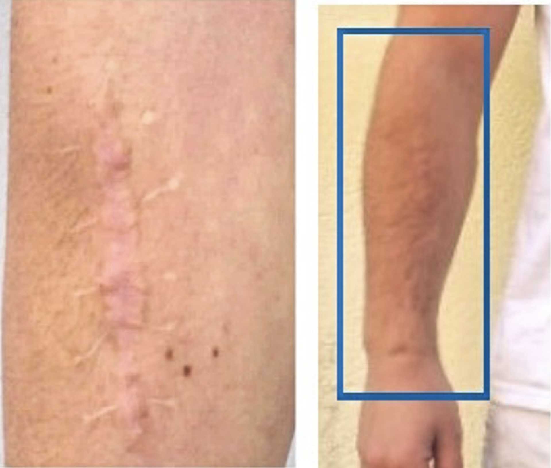 Műtéti heg | Fotó: Magyar Rendőrség