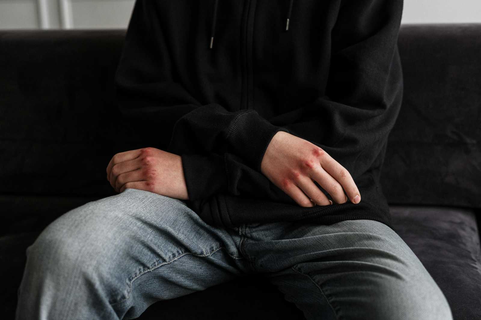 A fiú kötelező iskolai gyakorlaton vett részt egy sepsiszentgyörgyi szállodában, amikor állítólag szexuális agressziónak lett kitéve | Fotó: Illusztráció/Pexels