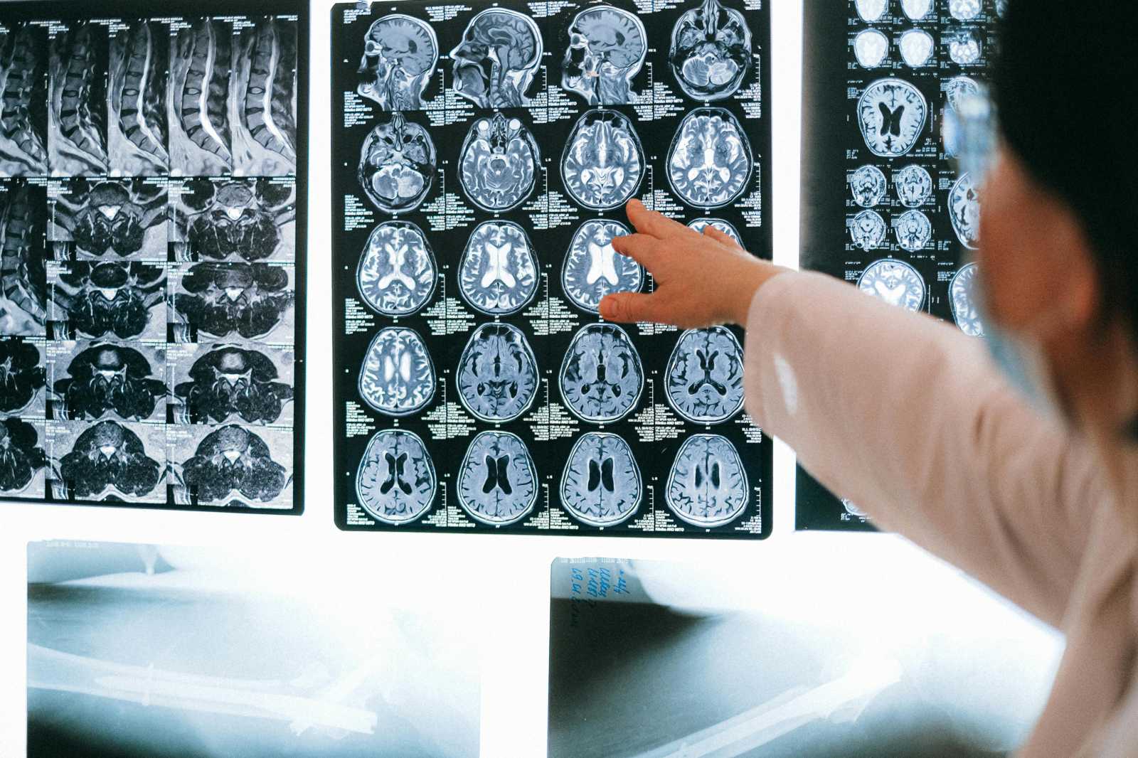 Fontos, hogy a megfelelő szakemberhez forduljunk a problémánkkal | Illusztráció: Pexels