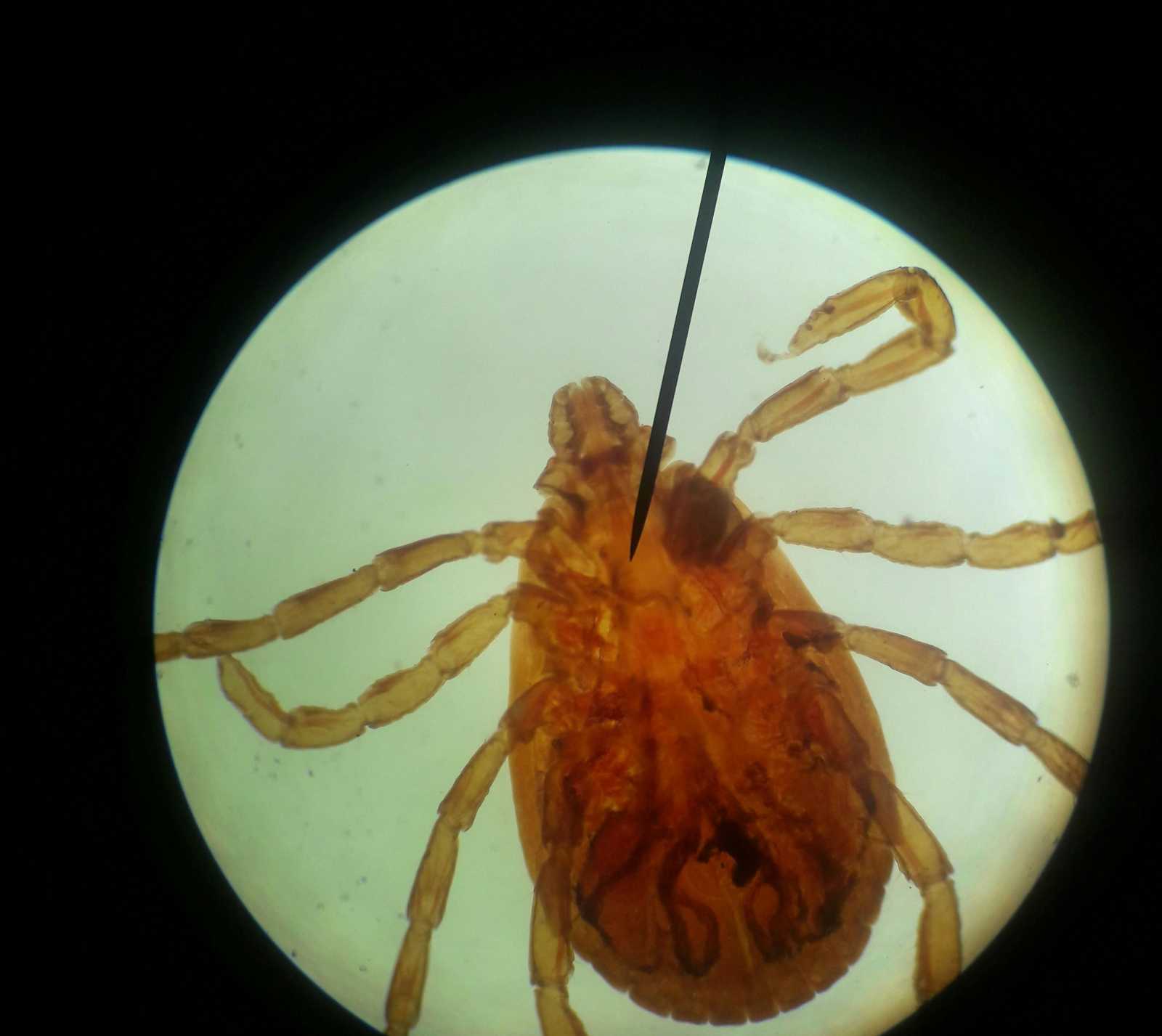 A Lyme-kórt okozó baktériumra tudják tesztelni. | Fotó: Pexels
