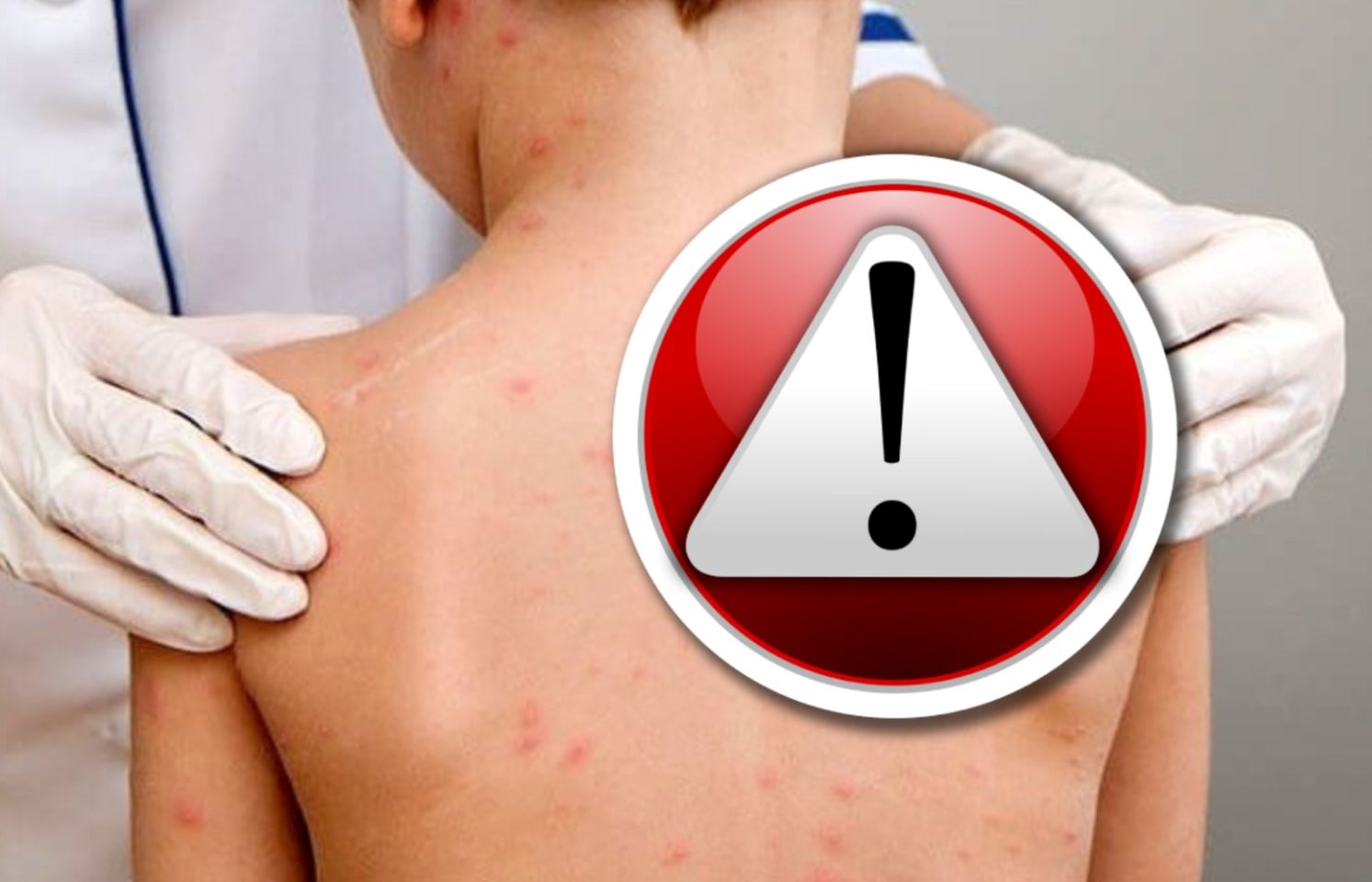 Gyakran figyelmeztetnek: súlyos szövődményei lehetnek. | Fotó: Pixabay