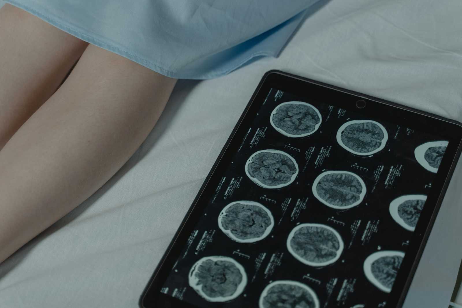 Neuromuszkuláris betegségeket kezelnek majd a marosvásárhelyi kórházban | Illusztráció: Pexels