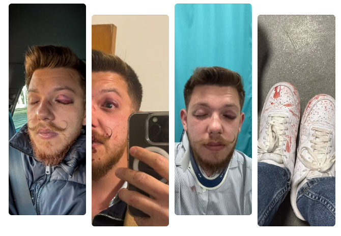 Béres Norbert Facebook-oldalán osztotta meg a fotókat | Fotó: Béres Norbert Facebook-oldala