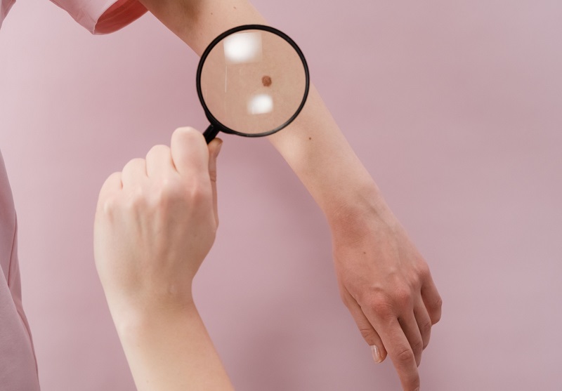 Érdemes ránézni a bőrünkre | Fotó: Pexels