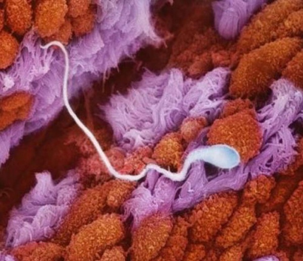 A spermium útban a petesejt felé