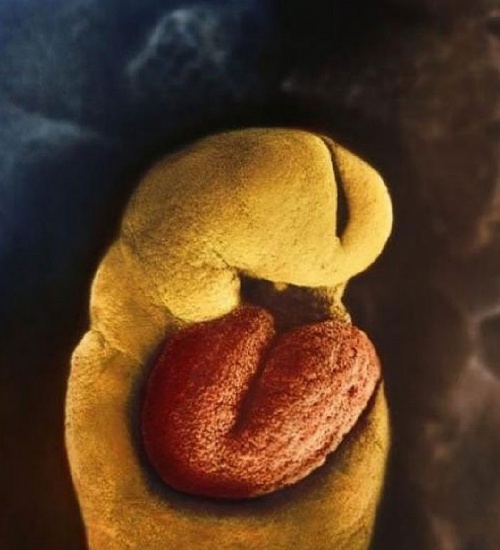 Az embrió szíve már a 18-ik napon dobogni kezd